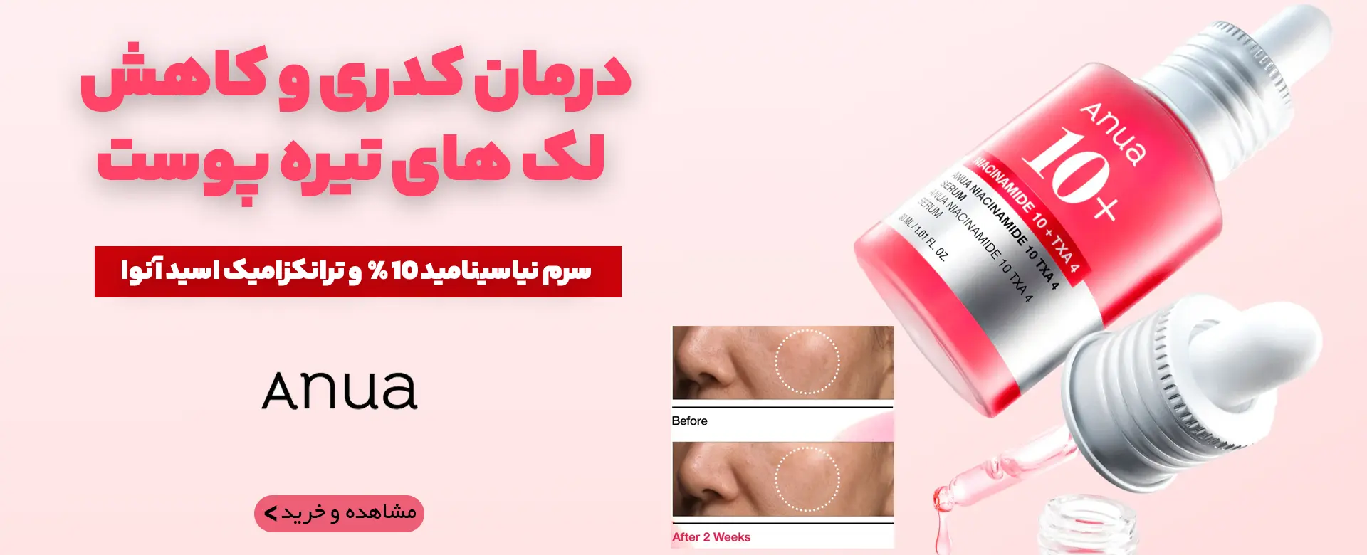 بنر سرم نیاسینامید آنوا دسکتاب | فروشگاه آنلاین لوازم آرایشی نلسا شاپ