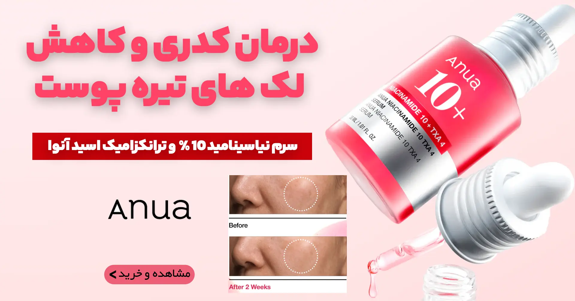 بنر سرم نیاسینامید آنوا موبایل | فروشگاه آنلاین لوازم آرایشی نلسا شاپ