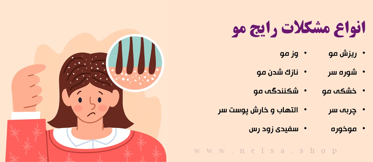 مشکل موی-مشکلات رایج موی سر