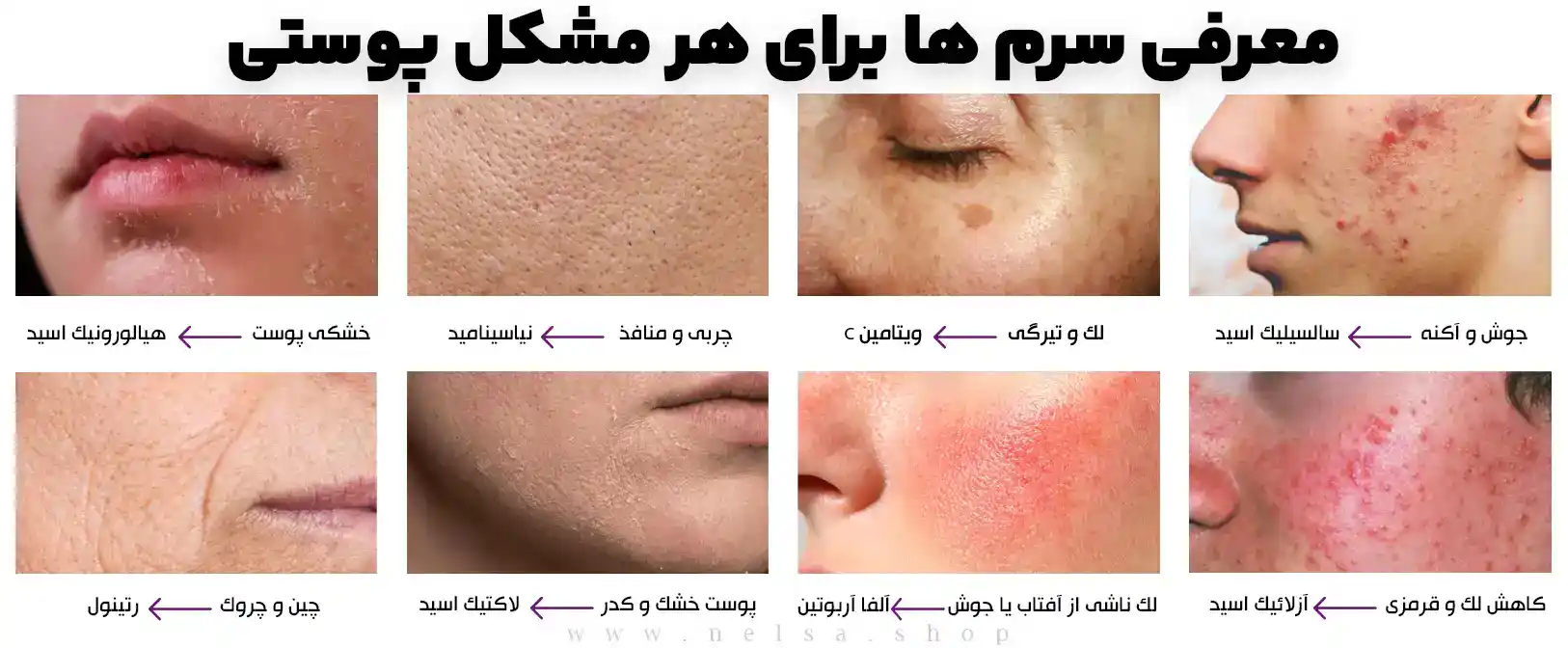 معرفی سرم ها برای هر مشکل پوستی