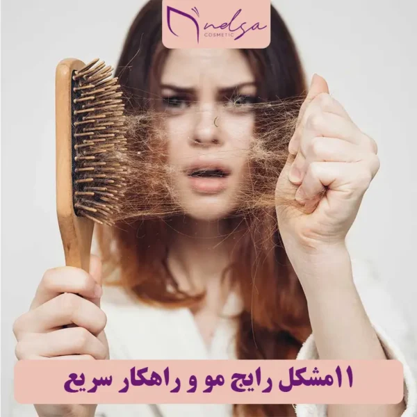 ۱۱ مشکل مو رایج و راهکارهای طلایی برای داشتن موهای سالم | فروشگاه آنلاین لوازم آرایشی نلسا شاپ