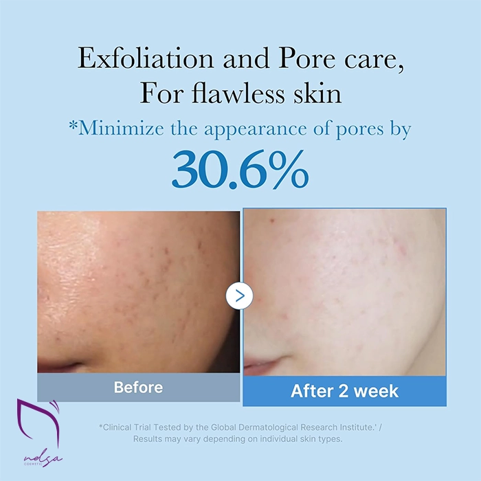 اثرات تونر Zero Pore مدی کیوب - کنترل منافذ و چربی پوست اثرات تونر Zero Pore مدی کیوب - کنترل منافذ و چربی پوست