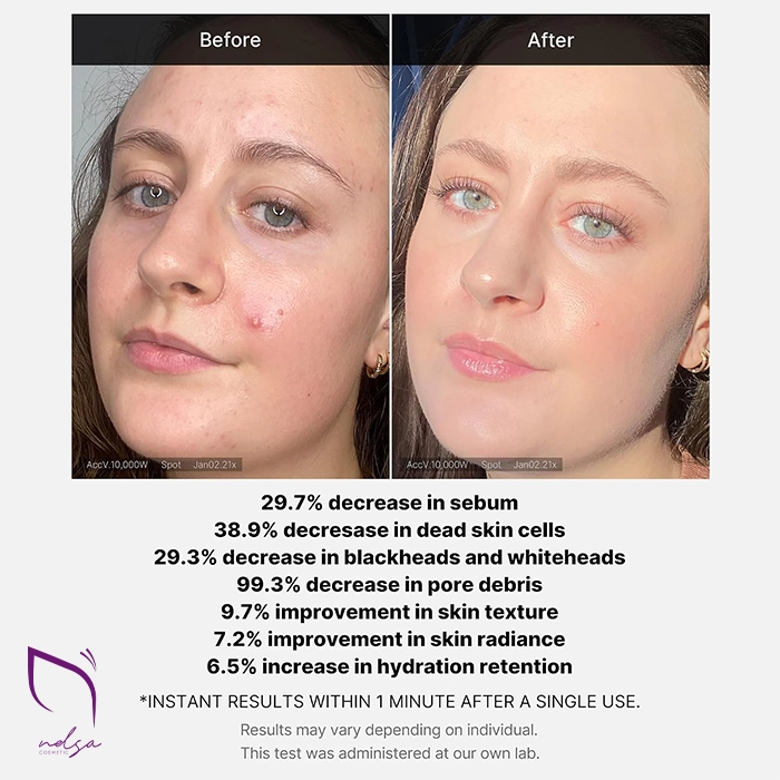 تاثیرات سرم پیلینگ سوکسینیک اسید مدی کیوب خرید سرم پیلینگ سوکسینیک اسید مدی کیوب