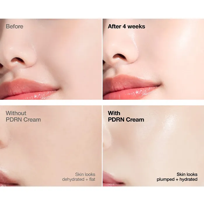 قیمت کرم مرطوب کننده PDRN و هیالورونیک اسید آنوا خرید کرم مرطوب کننده PDRN و هیالورونیک اسید آنوا